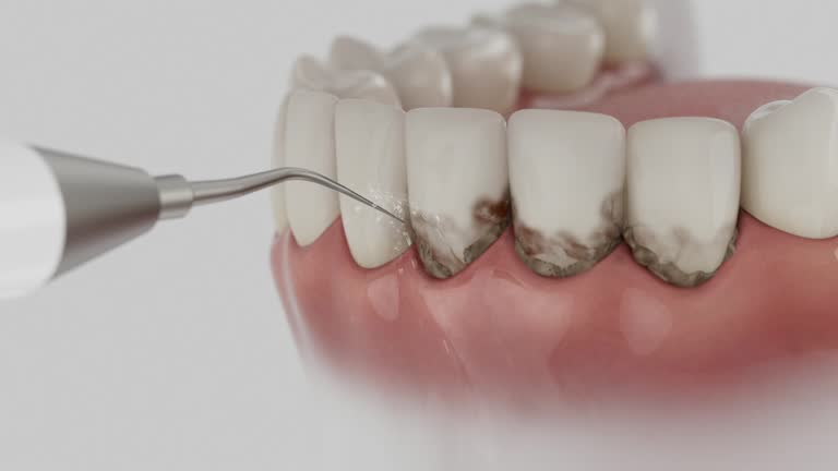 Reliable Teeth Cleaning And Checkup contractor in Plainview, NE by Smile Center Dentistry